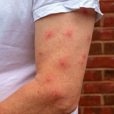 Ухапвания от бълха