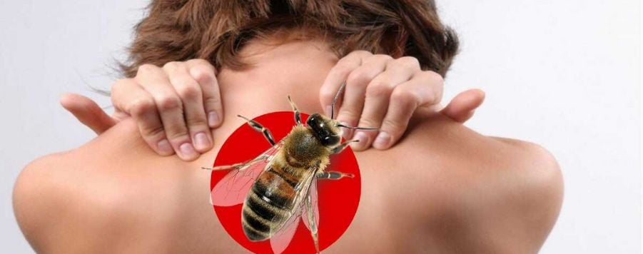 Какво да правим при ухапване от пчела